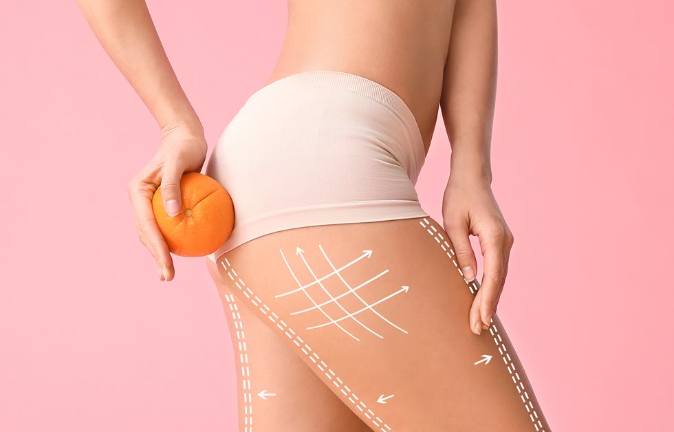 Žena drži naranču na butini i po cijeloj nozi su joj iscrtane bijele isprekidane linije.